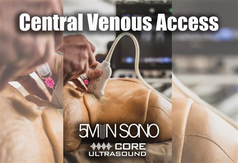 Central Venous Access 2020 Edition Core Ultrasound