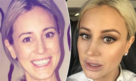 Has Pr Queen Roxy Jacenko Stopped Getting Lip Fillers Daily Mail Online