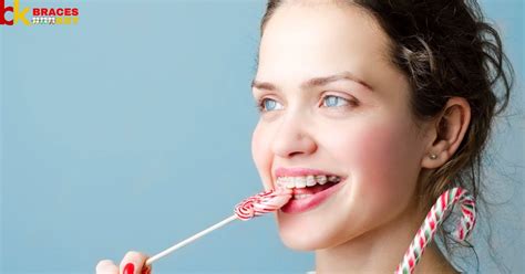 What Candies Can You Eat With Braces