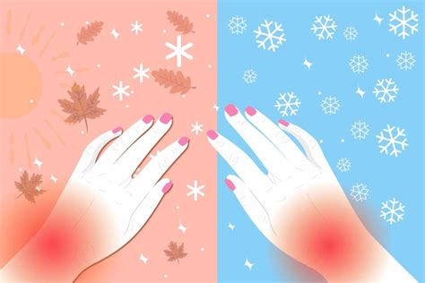 Arthritis Joint Pain And Cold Weather Stay Healthy And Safe In Winter