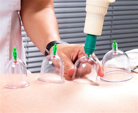 Have Been Wanting To Get Hijama Therapy Done For So Long Cant Find Any Clinic In Chennai
