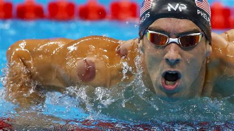 Michael Phelps Among Olympians Covered In Large Red Circles From Ancient Healing Technique Of