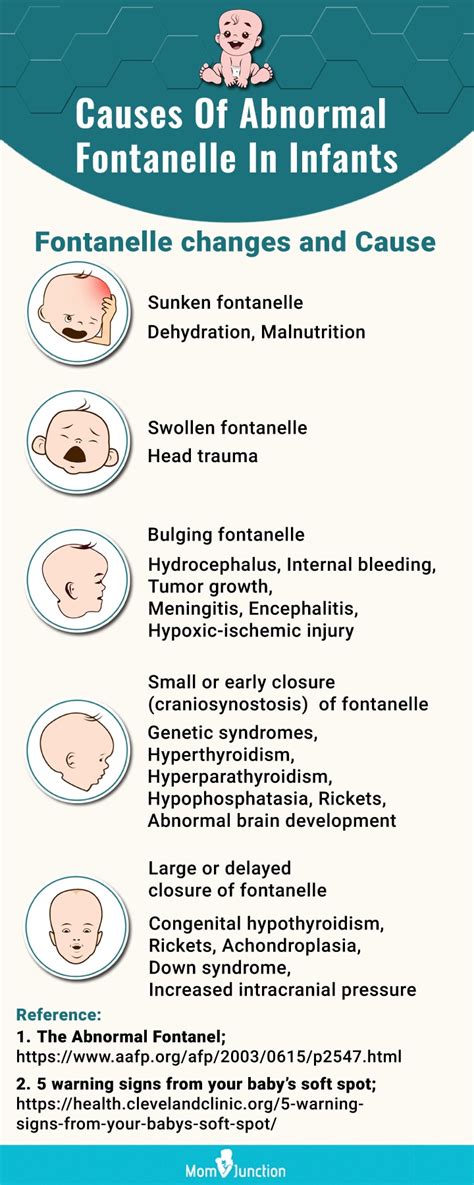 Baby Sunken Fontanelle Soft Spot Signs Causes And Treatment