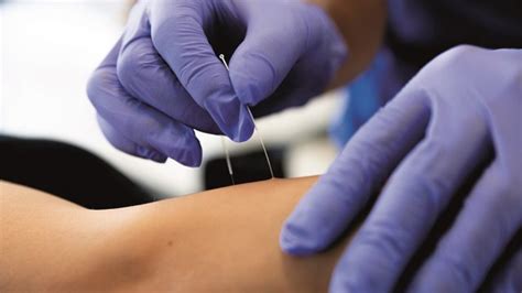 Trigger point injections can help relieve chronic muscle pain. Curso presencial - Trigger Points (Abr 2021) - Porto