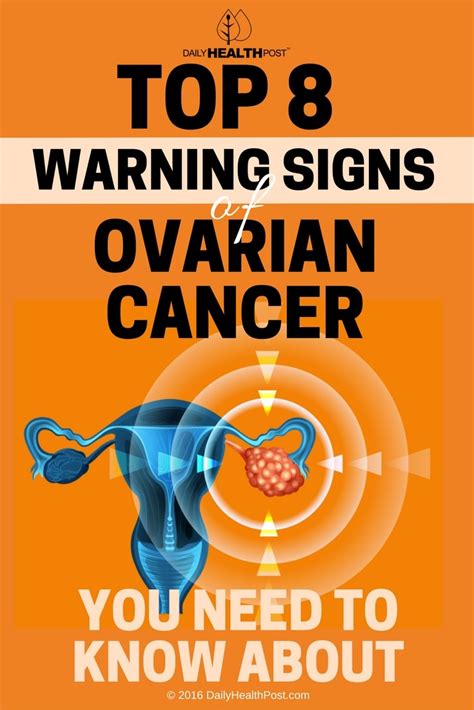 Top 8 Warning Signs Of Ovarian Cancer Women