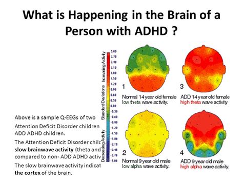 What Does Adhd Look Like In A 9 Year Old Carol Jones Addition Worksheets