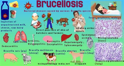 Pathology Of Brucellosis Bacterial Diseases Pathology Medical Knowledge