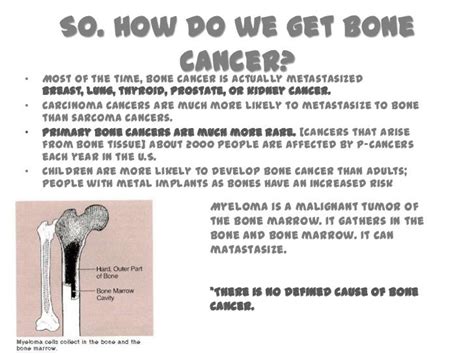 Health Is Wealth Picture Guide To Bone Cancers