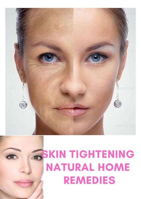 Pin On Skin Tightening Remedies