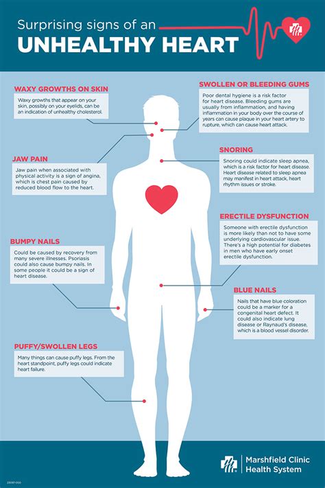 Heart Failure Symptoms Chart