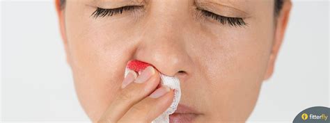 Nose Bleed In Children Causes Prevention And Treatment Fitterfly Blog