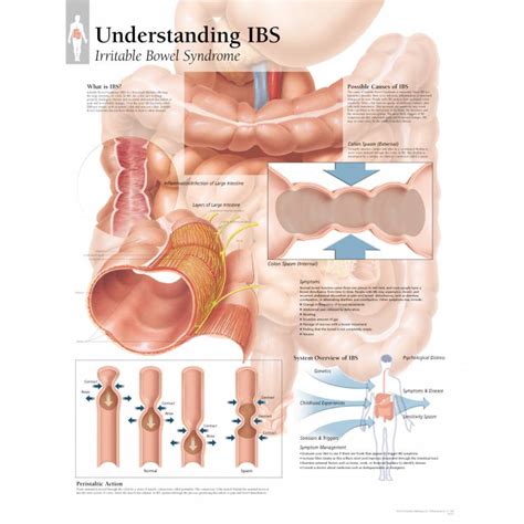 Scientific Publishing Understanding Ibs Irritable Bowel Syndrome Chart