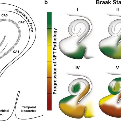 Progressive Accumulation Of Nfts Within The Transentorhinal