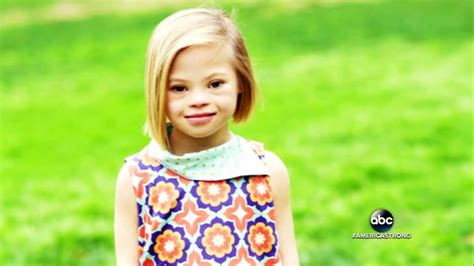 Down syndrome is a genetic disorder that causes physical problems and intellectual disabilities. 7-year-old girl explains why Down syndrome is 'not scary ...