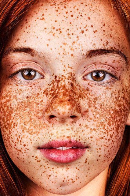 breathtaking photo series shows the undeniable beauty of freckles beautiful freckles freckles