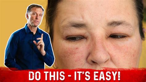 how to fix the swollen face facial puffiness and puffy eyes dr berg youtube