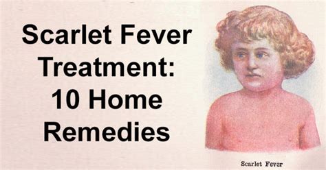 Scarlet Fever Treatment 10 Home Remedies David Avocado Wolfe