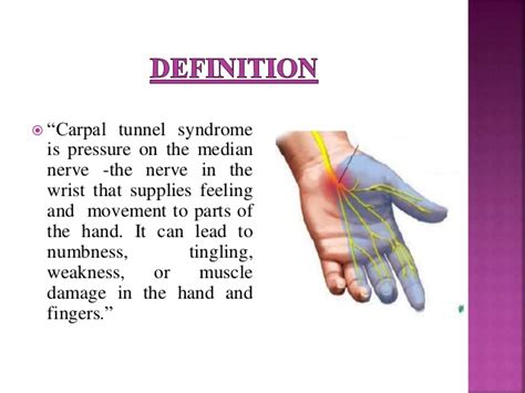 Carpal tunnel syndrome occurs when a major nerve in the hand — the median nerve — becomes compressed in the carpal tunnel, a narrow passageway on the palm side of your wrist that also houses the tendons that bend the fingers. Carpal tunnel syndrome