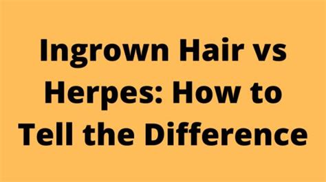 Ingrown Hair Vs Herpes How To Tell The Difference