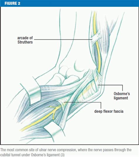 Carpal And Cubital Tunnel And Other Rarer Nerve Compression Syndromes