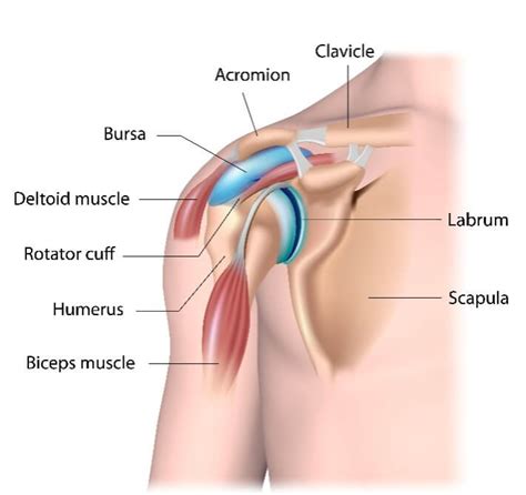 Subacromial Bursitis Orthopaedic Surgeon Adelaide Hot Sex Picture