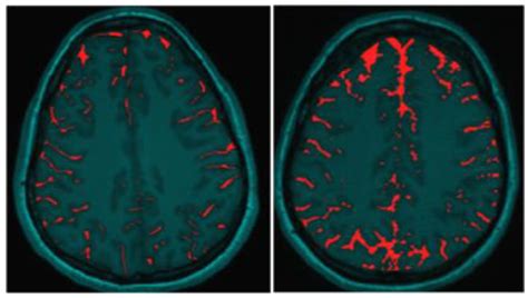 Brain Sciences Free Full Text A Proposed Mechanism For Development