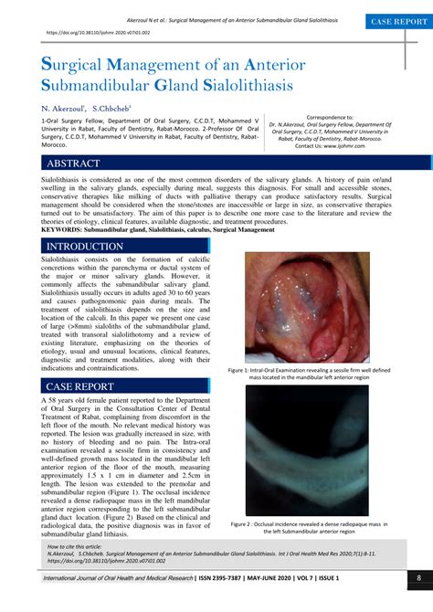 Pdf Surgical Management Of An Anterior Submandibular Gland Sialolithiasis