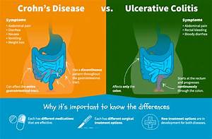 Crohn 39 S Disease Vs Ulcerative Colitis Disease Pinterest