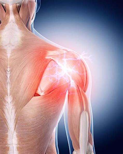 Pin On Joint Pain Relief