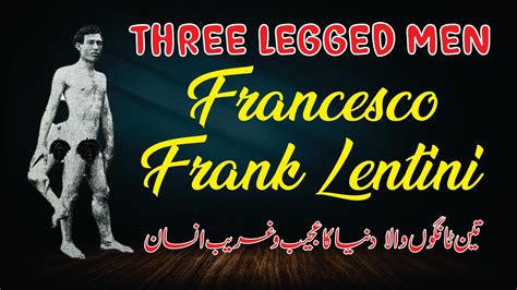 Three Legged Man Francesco Frank Lentini Youtube