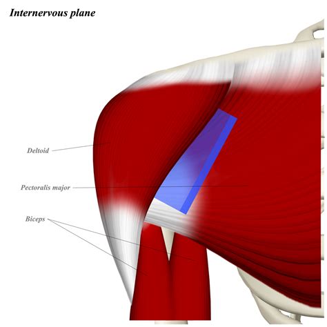 Shoulder Anterior Deltopectoral Approach Approaches Orthobullets