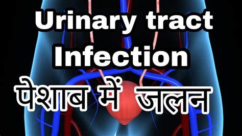 Urinary Tract Infection Uti Symptoms Diagnoses Causes Treatment Recurrent Uti In Hindi