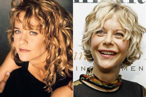 Meg Ryan Before And After Plastic Surgery 9 Celebrity Plastic