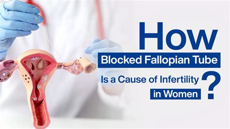 How Blocked Fallopian Tube Is A Cause Of Infertility In Women Best Ivf