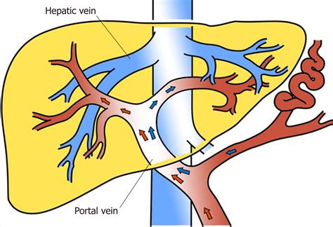 Targeted Puncture Of Left Branch Of Intrahepatic Portal Vein In