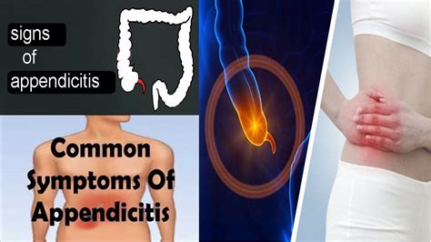 7 Symptoms Of Appendicitis You Need To Know Appendicitis Symptoms