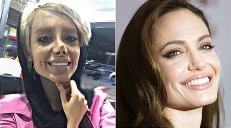 Iranian Teen Goes Through 50 Plastic Surgeries To Look Like Angelina