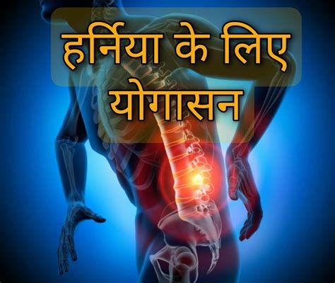 हर्निया के लिए 5 योगासन Hernia Ke Liye 5 Yoga Poses In Hindi