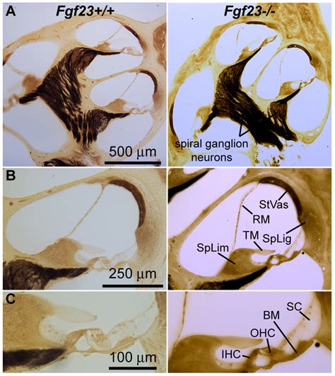 Mid Modiolar Cochlear Sections From Fgf Left Column And Fgf Mice