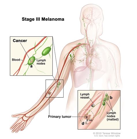 40 lymph nodes in elbow diagram - Wiring Diagram Info