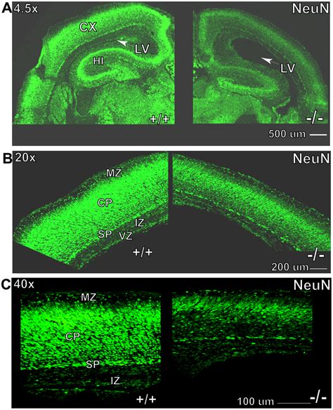 Confocal Images Of Neuronal Nuclear Antigen Neun Stained Brain