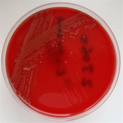 Listeria monocytogenes is the species of pathogenic bacteria that causes the infection listeriosis. Listeria monocytogenes - Columbia Horse Blood Agar | Flickr