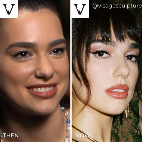 Singer Dua Lipa Looks Amazing Then And Now A Subtle Nose Job Can Just