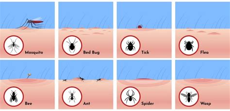 How To Treat Bug Bites A Comprehensive Guide Ihsanpedia