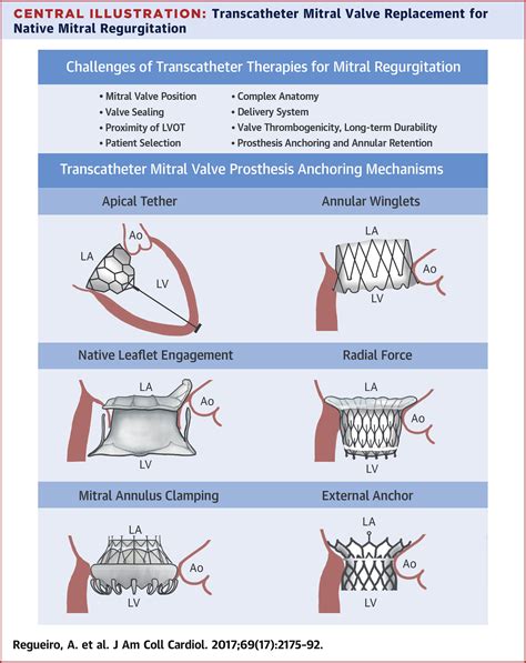 Transcatheter Mitral Valve Replacement Insights From Early Clinical
