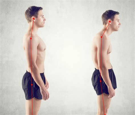 Mind Your Posture 4 Back Breaking Habits And How To Fix Them Spinal