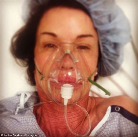 Janice Dickinson Claims Stem Cell Treatment Helped Her From Car Park