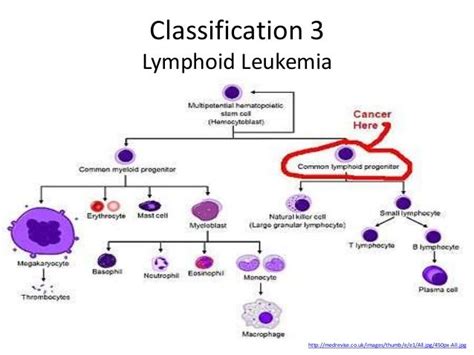 Leukemia Flow Chart