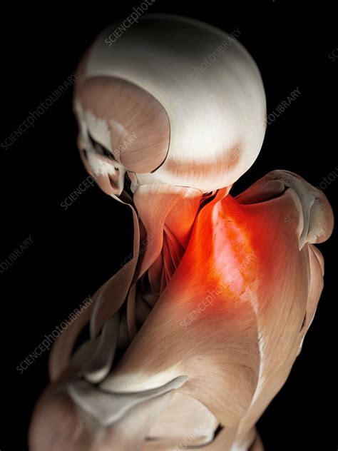 Human Neck Muscles Artwork Stock Image F009 4101 Science Photo