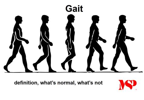 gait definition whats normal whats